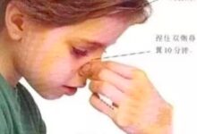 孩子流鼻血后仰头、棉花止血都不对（最正确的处理方法）-幼师课件网